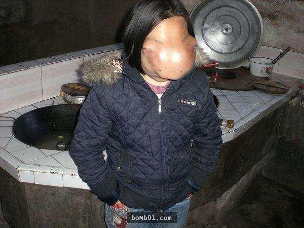 河马脸女孩:看到母亲做的事后超想替她们喝彩