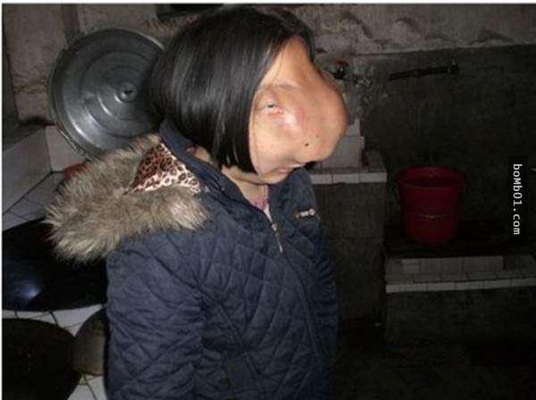 河马脸女孩看到母亲做的事后超想替她们喝彩