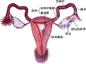 北京不孕不育医院专家揭秘输卵管肿瘤典型的三