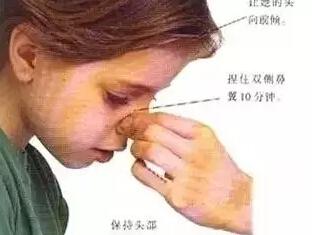 家长注意:孩子流鼻血,千万别用这4种错误方法!