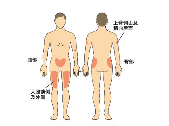 为什么胰岛素要注射到皮下