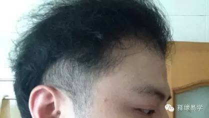 骨相学:头骨之十二起骨论法(一)
