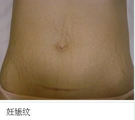 昌邑人口萎缩_昌邑一中图片