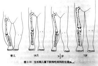 一张图看懂宝宝是不是o型腿_手机搜狐网