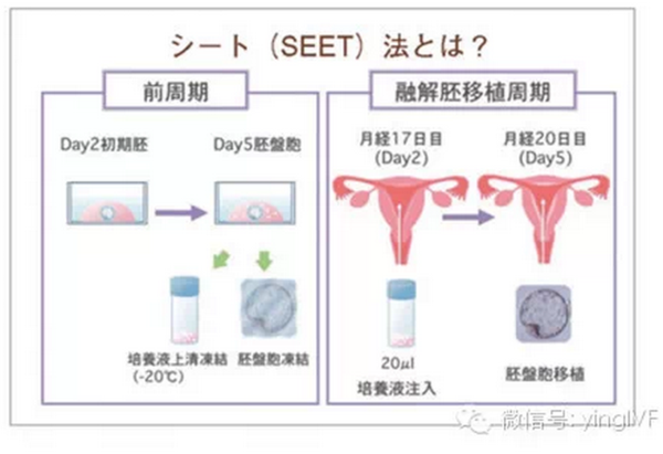 日本英医院特色技术-SEET薄膜移植和二阶段移