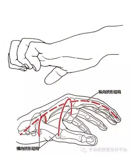 "手和指的种种畸形"直接影响手功能
