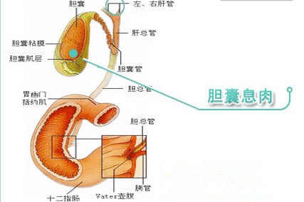 北京胆结石医院:引起胆囊息肉的原因