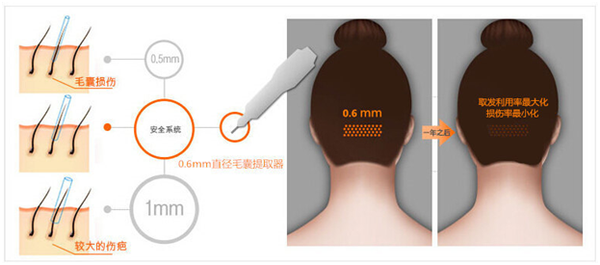 亚根挺人口_人口普查