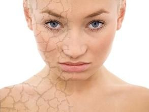 激素依赖性皮炎脸干的原因及如何预防?