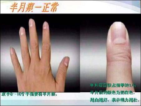 从手指甲看健康!