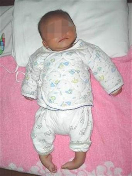 6个月宝宝脑瘫有什么表现