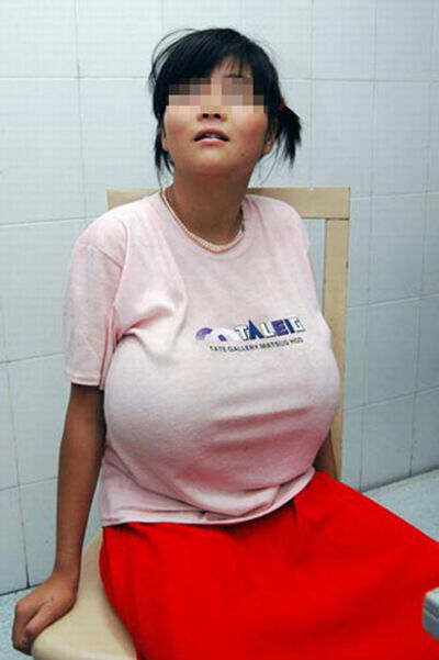 中国第一波霸胸围1 1米乳房堪比足球