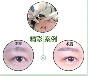 医学纹绣效果好吗?