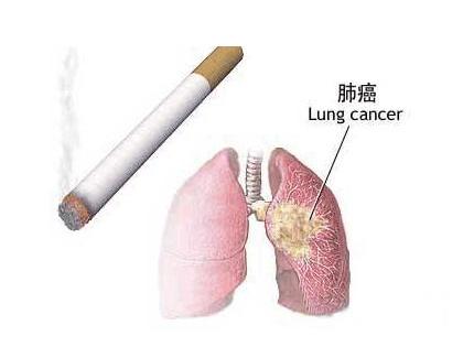 肺癌的症状有哪些