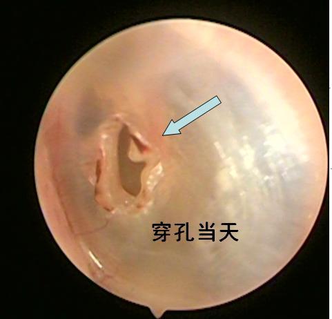 一记耳光惹得祸