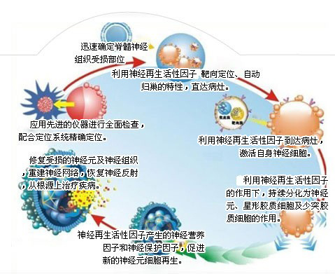 你了解脑梗塞后遗症的病因吗