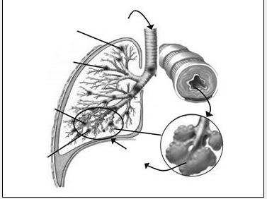 支气管哮喘的中医病理及治疗