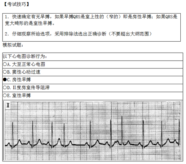 实践技能考试辅助检查之房性期前收缩