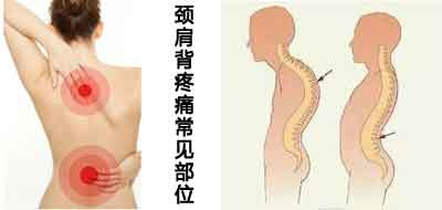 颈椎医院排名_医院牵引颈椎图片(3)