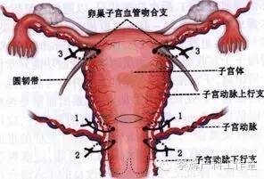 3,血管结扎术盆腔血管结扎法:包括供应子宫动脉结扎和髂内动脉结扎