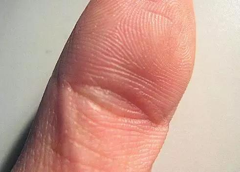 大拇指第一节的指节纹形如"眼睛,谓之夫子眼,又叫做凤眼纹.