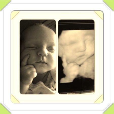 太神奇了，宝宝B超图和出生后图片对比-搜狐母婴