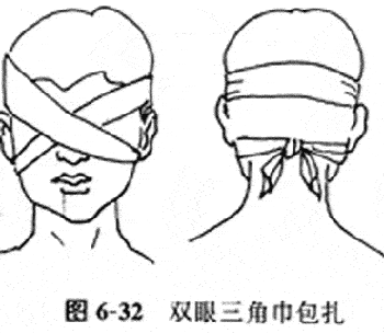 大致的一些包扎方法如下图