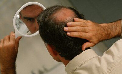 前额头发稀少的原因及治疗方法