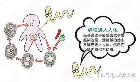 乱吃驱虫药,蛔虫钻进6岁女童眼睛里!