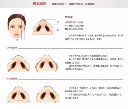 鼻子不美怎么型?各类鼻型的手术方法。