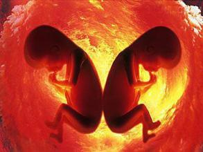 胎儿缺氧会有哪些求救信号