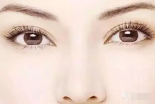 【yestar】双眼皮手术后5大消肿护理方法