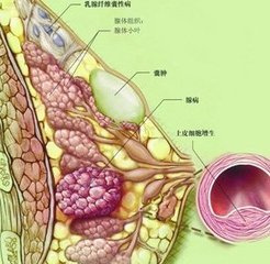 微创旋切术切除乳腺结节不留痕