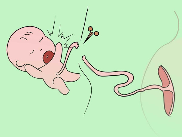 新生儿脐带该如何正确护理?