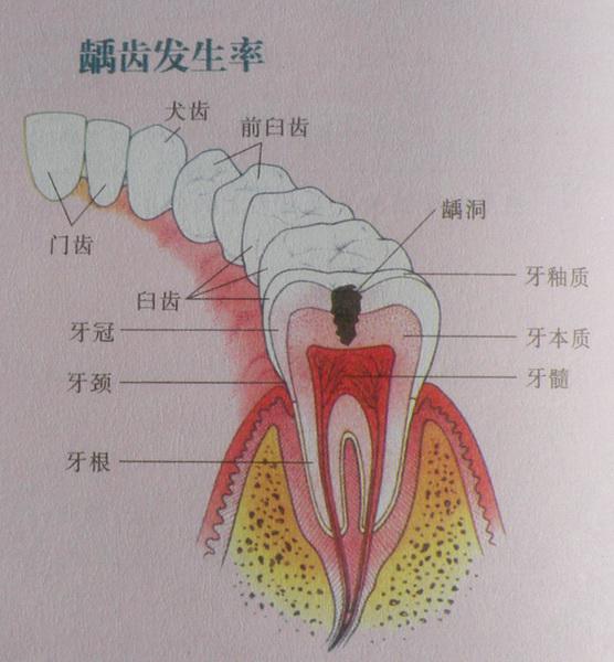 牙病不治易引发内科疾病-丽元口腔