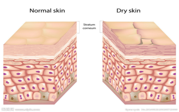 皮肤干燥 让你变成黄脸婆