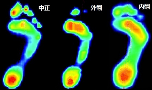 鞋子也怕脚歪:买跑鞋,先要了解你的脚(有图有视