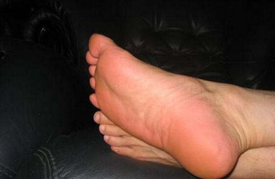 男人脚底出汗是肾虚还是脾虚 出汗过多如何防治
