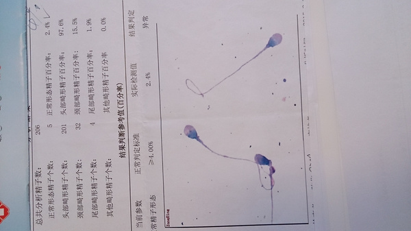 一位门诊患者的精液分析报告,图1显示该患者正常形态精子百分率只有2