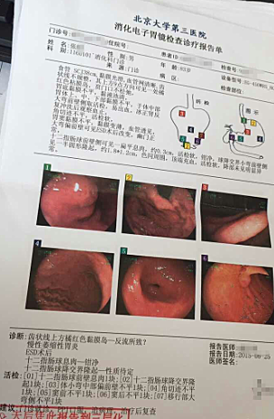 治疗胃癌的方法都有哪些 治疗胃癌的方法