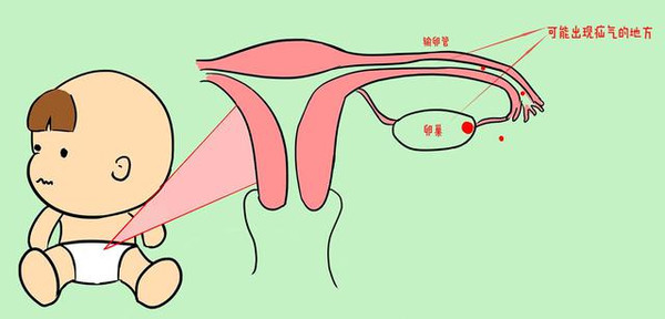 如果宝宝哭闹是得了疝气吗?