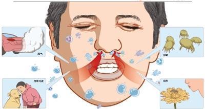 鼻炎的保健和过敏性鼻炎的治疗