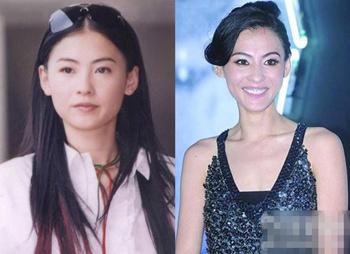 女明星瘦脸过度闹哪样!小心惨变僵尸脸