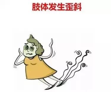脑血栓前兆的6个暗号,警惕!