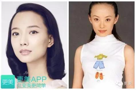 发际线过低,在前额或鬓角发髻边缘有过多的毛发,显得前额过窄,发型不