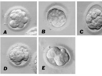 揭秘试管婴儿胚胎是如何评级的