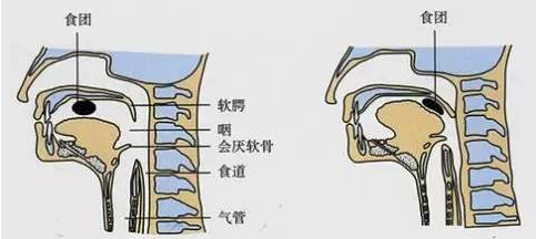 老年人反复发烧怎么办