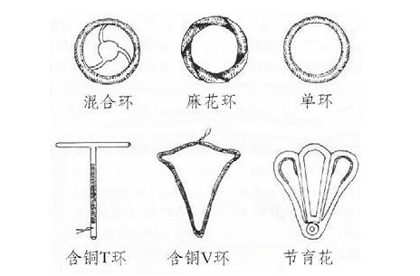 避孕环又称为节育环,宫内节育器,是在中国计划生育政策背景下特有