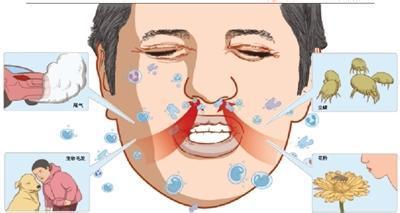 过敏性鼻炎康复技巧