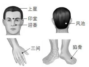 推拿专家:不花钱就可以治疗过敏性鼻炎